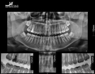 radiology-OPG-pacs