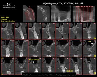 radiology-OPG-pacs