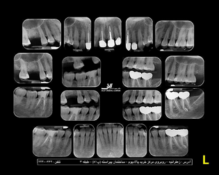 radiology-OPG-pacs